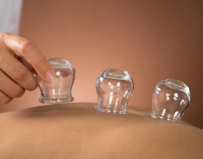 Holistic-Bodyworks-Cupping-Therapy