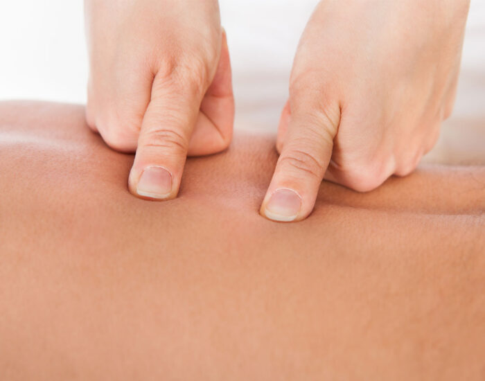 Myotherapy Image depicting myotherapy treatment