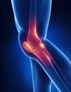 Image depicting symptoms associated with patella tendinopathy